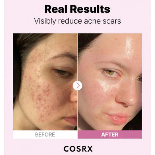 COSRX The Niacinamide 15 serums 20 ml